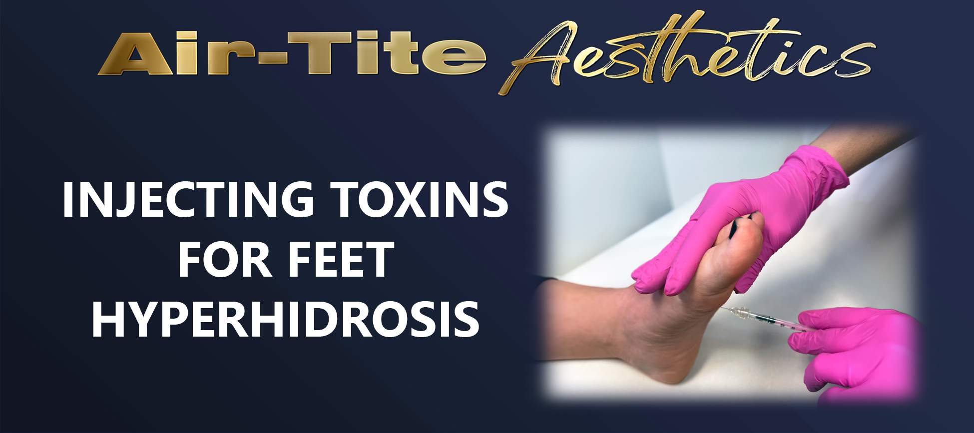 Injecting Botox in the Feet for Hyperhidrosis